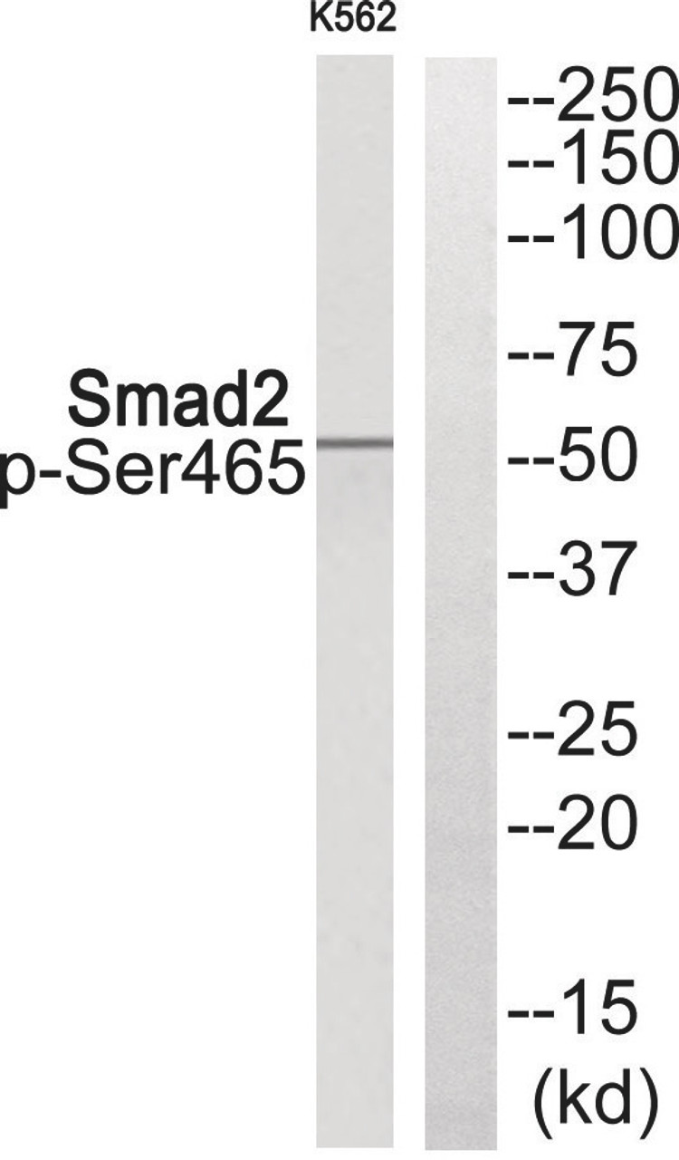 Western blot analysis of extracts from K562 cells using Smad2 (Phospho-Ser465) Antibody. The lane on the right is treated with the antigen-specific peptide.
