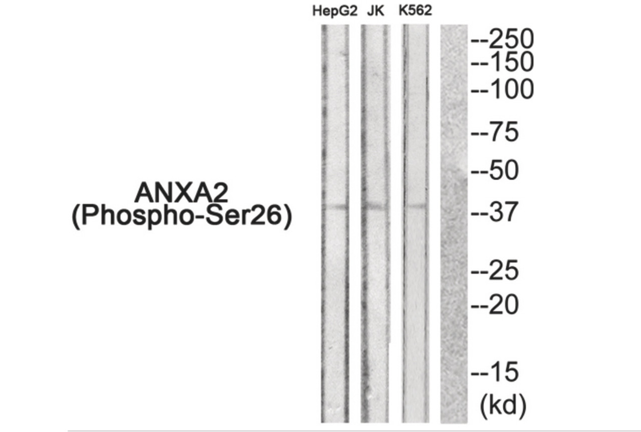 Western blot analysis of extracts from HepG2 cells JK cells and K562 cells using ANXA2 (Phospho-Ser26) Antibody. The lane on the right is treated with the antigen-specific peptide.