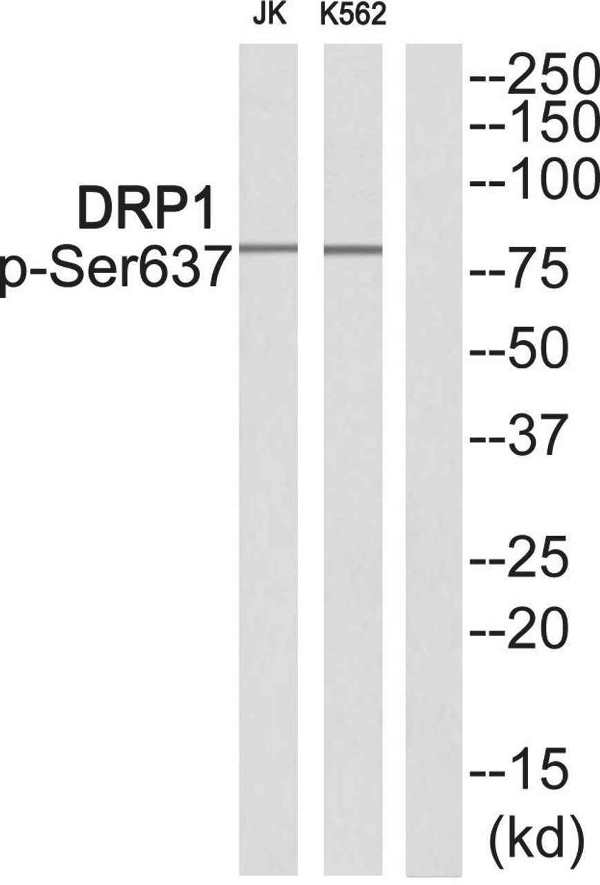 Western blot analysis of extracts from JK cells and K562 cells using DRP1 (Phospho-Ser637) Antibody. The lane on the right is treated with the antigen-specific peptide.