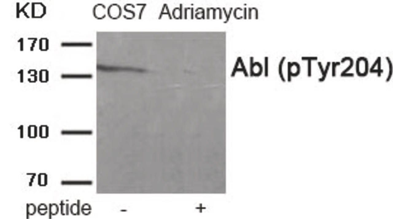 Western blot analysis of extracts from COS7 cells treated with Adriamycin using Abl (Phospho-Tyr204) Antibody. The lane on the right is treated with the antigen-specific peptide.