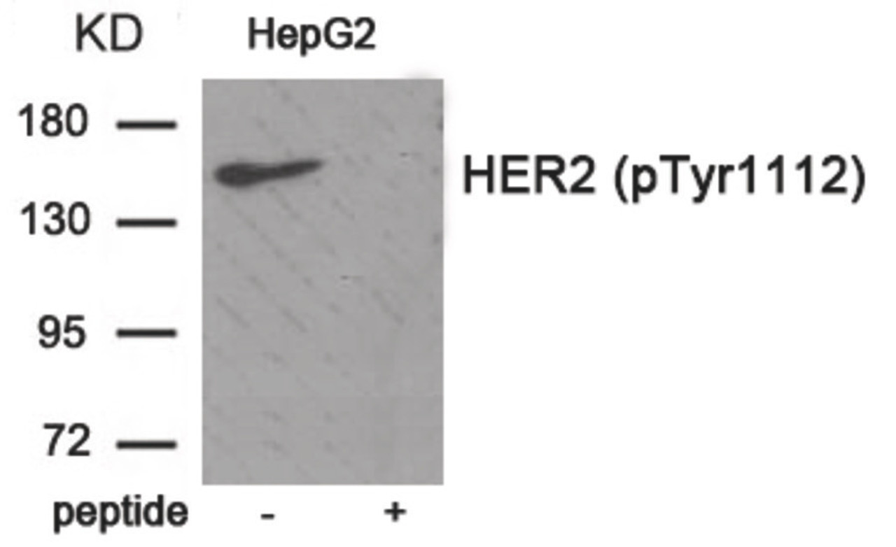 Western blot analysis of extracts from HepG2 tissue using HER2 (Phospho-Tyr1112) Antibody. The lane on the right is treated with the antigen-specific peptide.