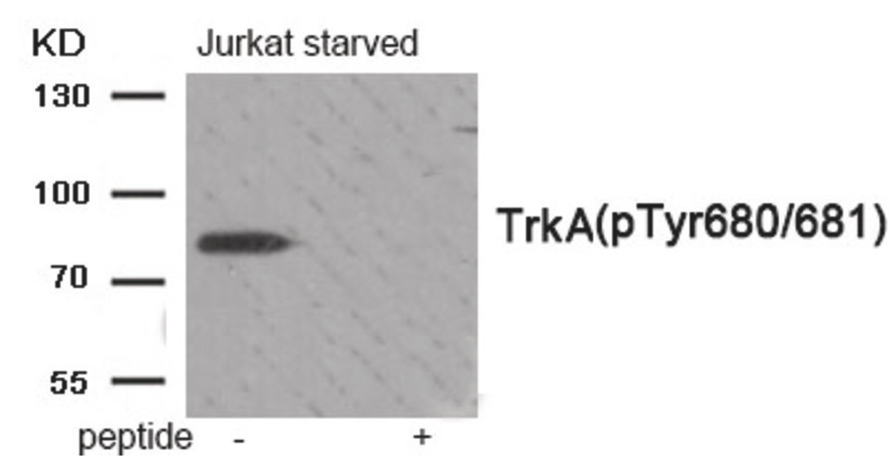 Western blot analysis of extracts from Jurkat cells treated with starved using Phospho-Trk A (Tyr680/Tyr681) Antibody. The lane on the right is treated with the antigen-specific peptide.