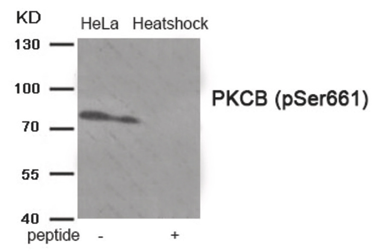 Western blot analysis of extracts from HeLa cells treated with Heatshock using Phospho-PKCB (Ser661) Antibody. The lane on the right is treated with the antigen-specific peptide.