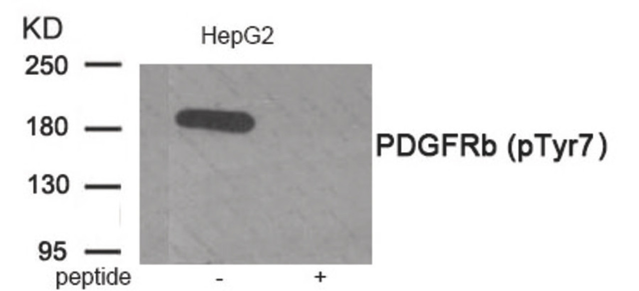 Western blot analysis of extracts from HepG2 tissue using PDGFRb (Phospho-Tyr771) Antibody. The lane on the right is treated with the antigen-specific peptide.