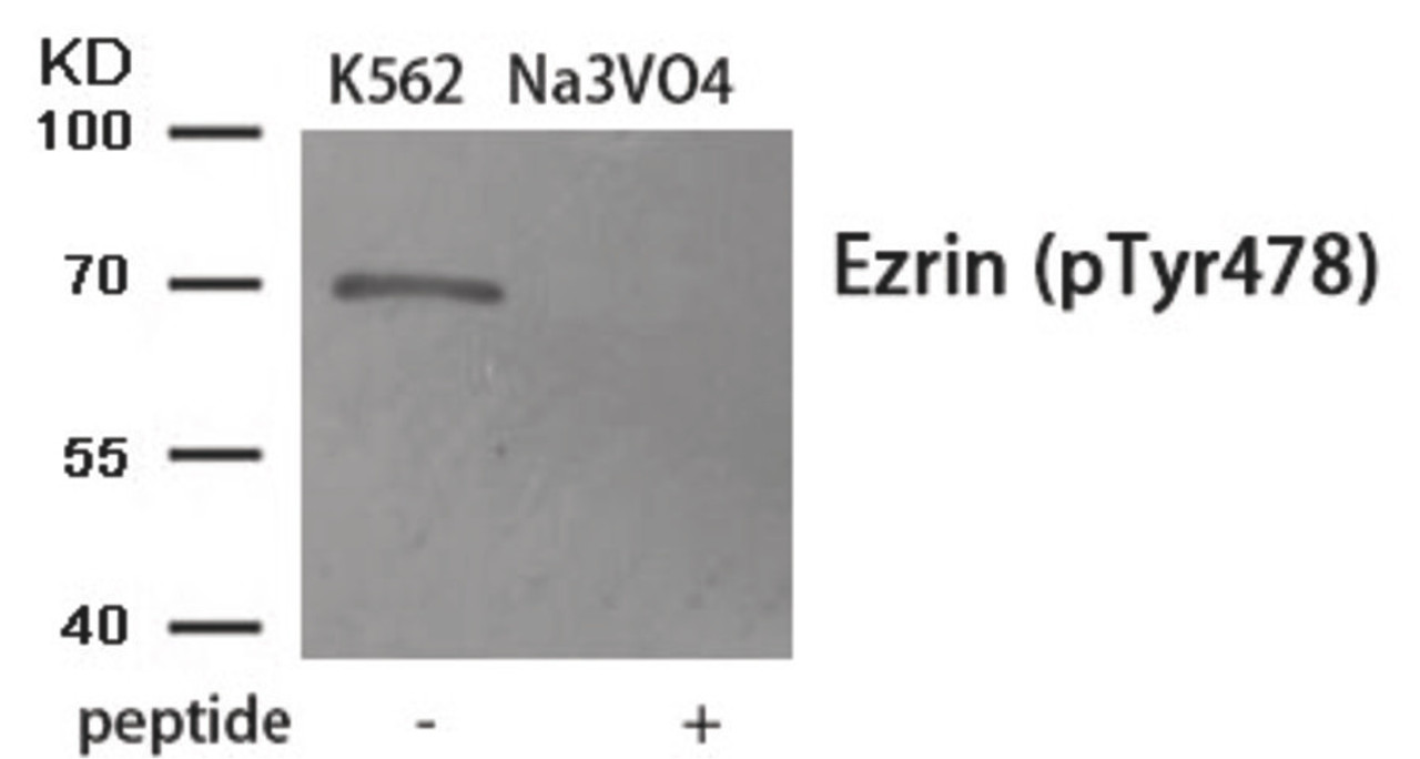 Western blot analysis of extracts from K562 cells treated with Na3VO4 using Phospho-Ezrin (Tyr478) Antibody. The lane on the right is treated with the antigen-specific peptide.