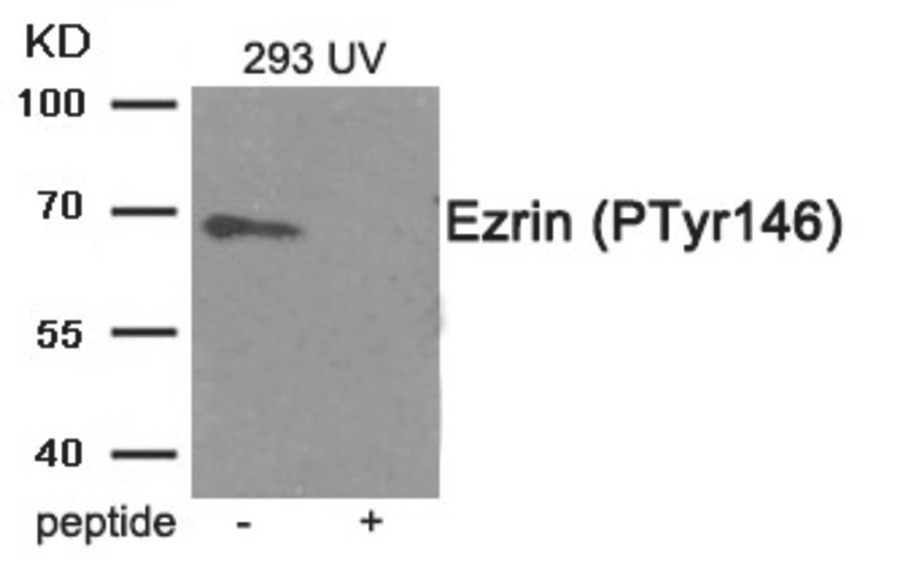 Western blot analysis of extracts from 293 cells treated with UV using Phospho-Ezrin (Tyr146) Antibody. The lane on the right is treated with the antigen-specific peptide.