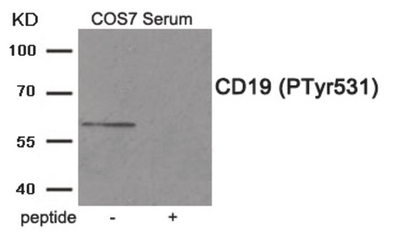 Western blot analysis of extracts from COS7 cells treated with Serum using Phospho-CD19 (Tyr531) Antibody. The lane on the right is treated with the antigen-specific peptide.