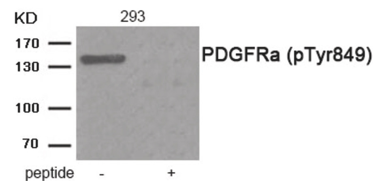 Western blot analysis of extracts from 293 tissue using PDGFRa (Phospho-Tyr849) Antibody. The lane on the right is treated with the antigen-specific peptide.