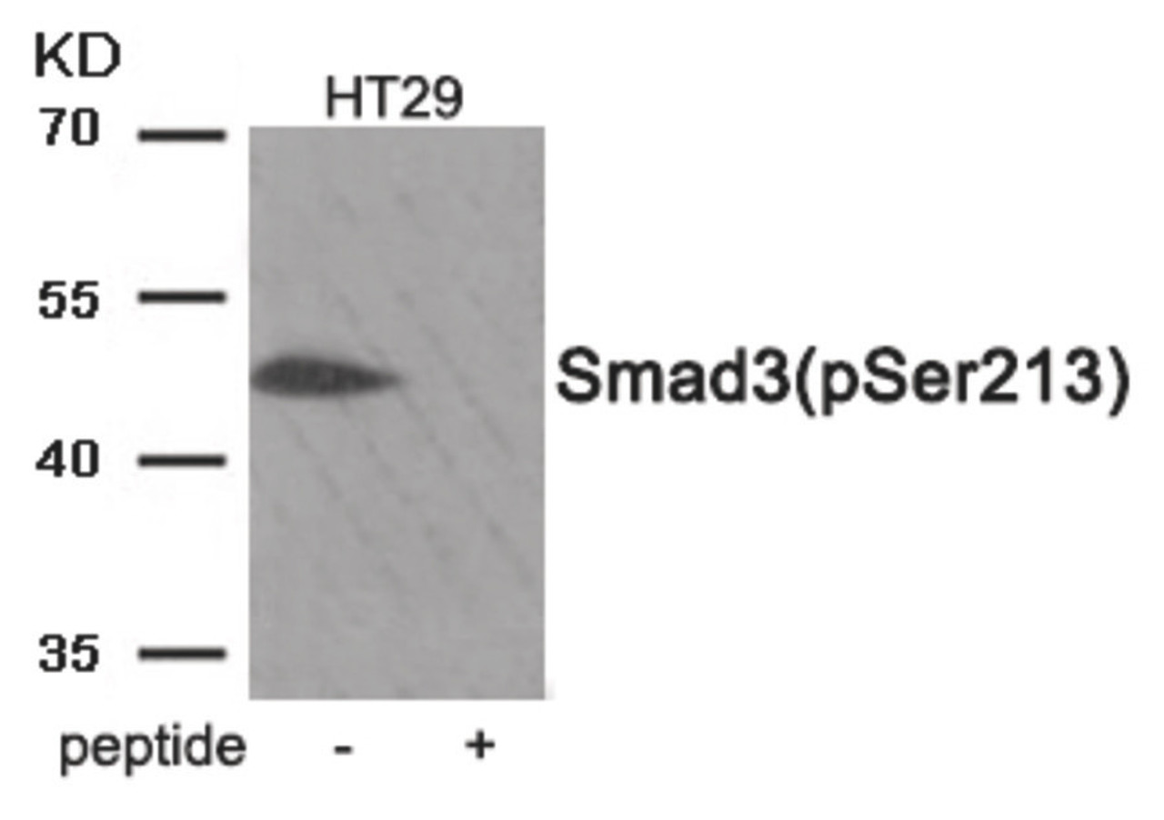 Western blot analysis of extracts from HT29 tissue using Smad3 (Phospho-Ser213) Antibody. The lane on the right is treated with the antigen-specific peptide.