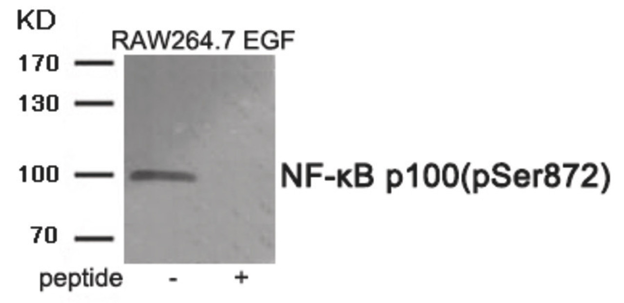 Western blot analysis of extracts from RAW264.7 cells treated with EGF using Phospho-NF-κB p100 (Ser872) Antibody. The lane on the right is treated with the antigen-specific peptide.