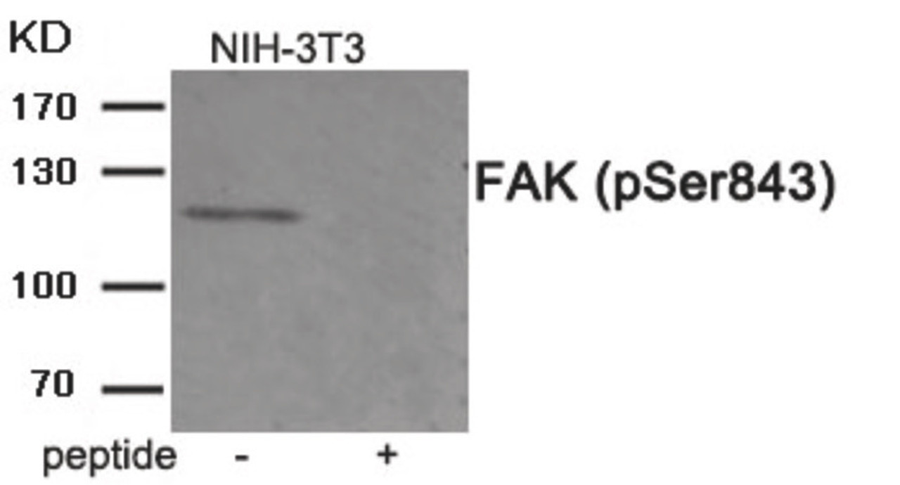 Western blot analysis of extracts from HepG2 cells treated with PMA using Phospho-FAK (Ser843) Antibody. The lane on the right is treated with the antigen-specific peptide.