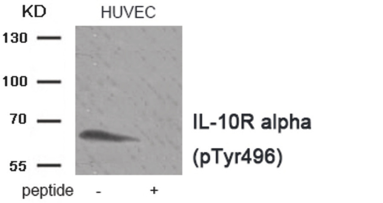 Western blot analysis of extracts HUVEC tissue using IL-10R alpha (Phospho-Tyr496) Antibody. The lane on the right is treated with the antigen-specific peptide.