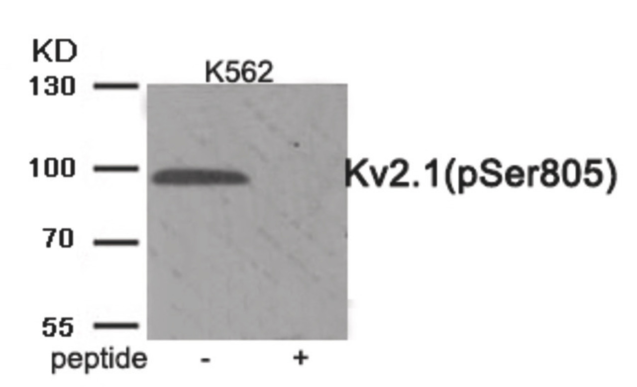 Western blot analysis of extracts from K562 cells treated with TNF using Phospho-Kv2.1 (Ser805) Antibody. The lane on the right is treated with the antigen-specific peptide.