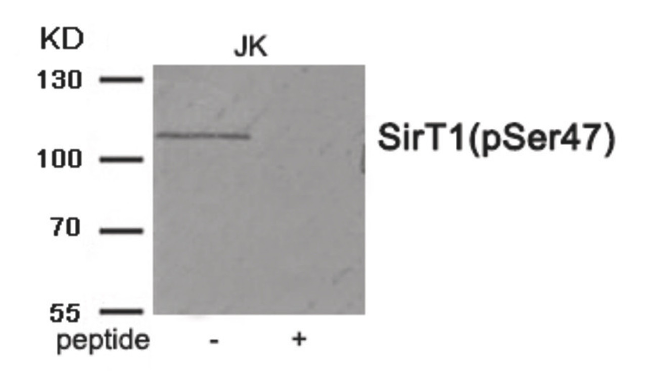 Western blot analysis of extracts from JK tissue using SirT1 (Phospho-Ser47) Antibody. The lane on the right is treated with the antigen-specific peptide.