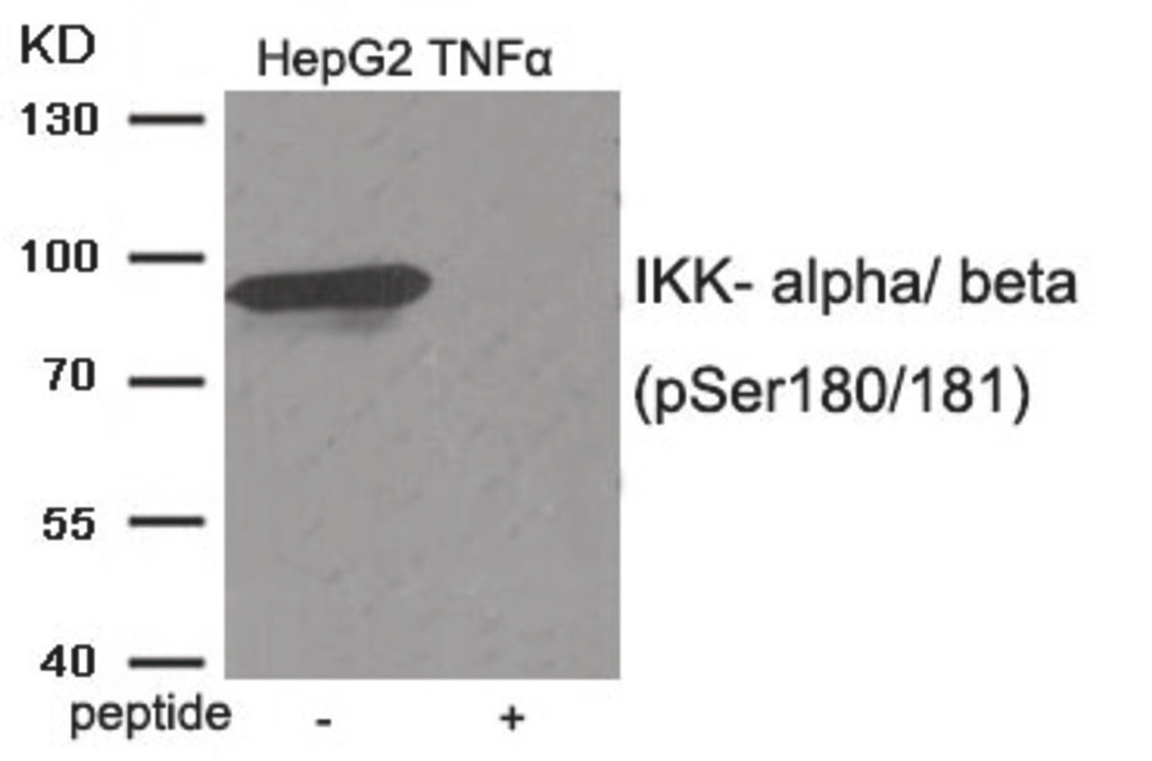Western blot analysis of extracts from HepG2 cells treated with TNF using IKK- alpha/ beta (Phospho-Ser180/181) Antibody. The lane on the right is treated with the antigen-specific peptide.