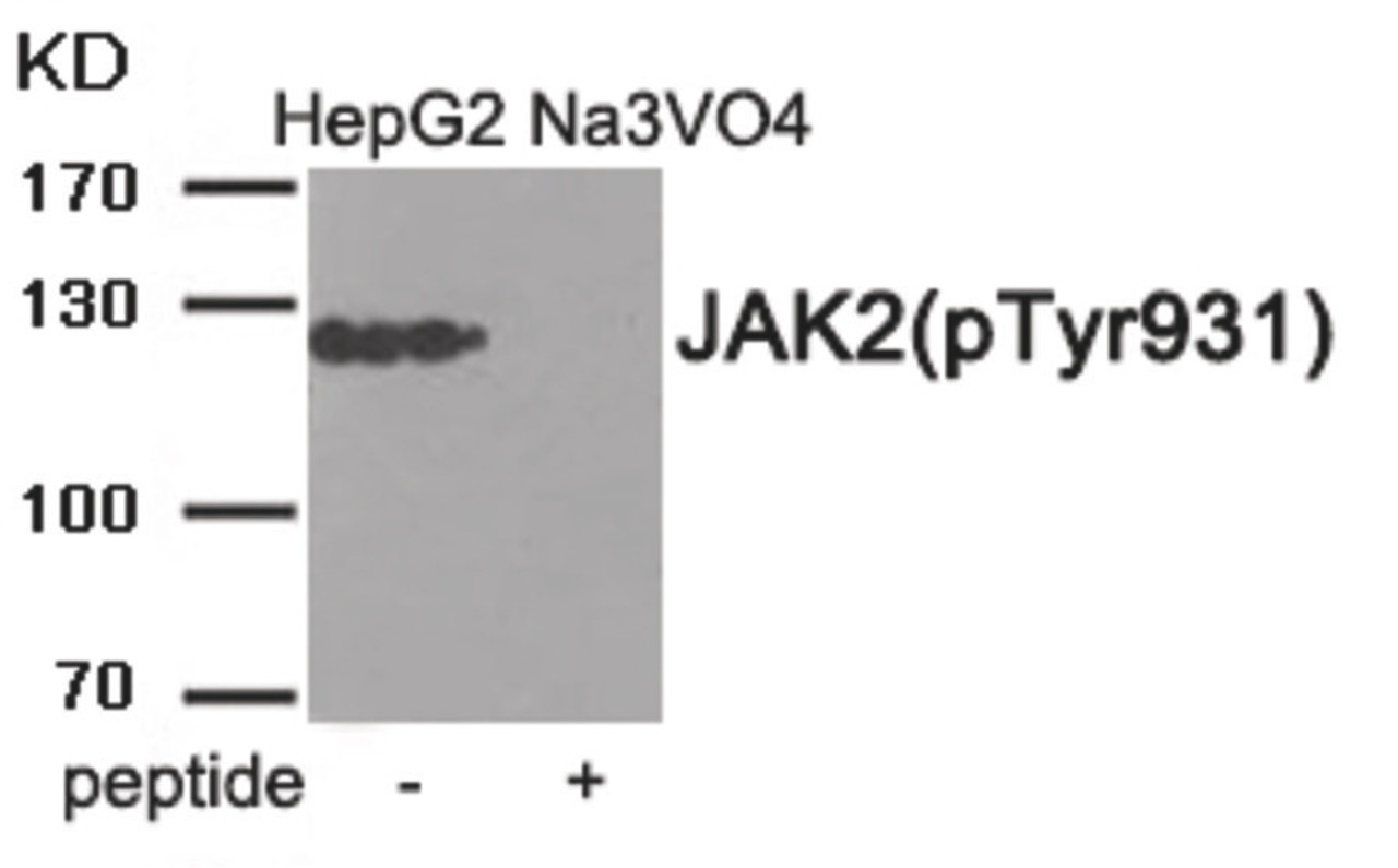 Western blot analysis of extracts from HepG2 cells treated with Na3VO4 using JAK2 (Phospho-Tyr931) Antibody. The lane on the right is treated with the antigen-specific peptide.