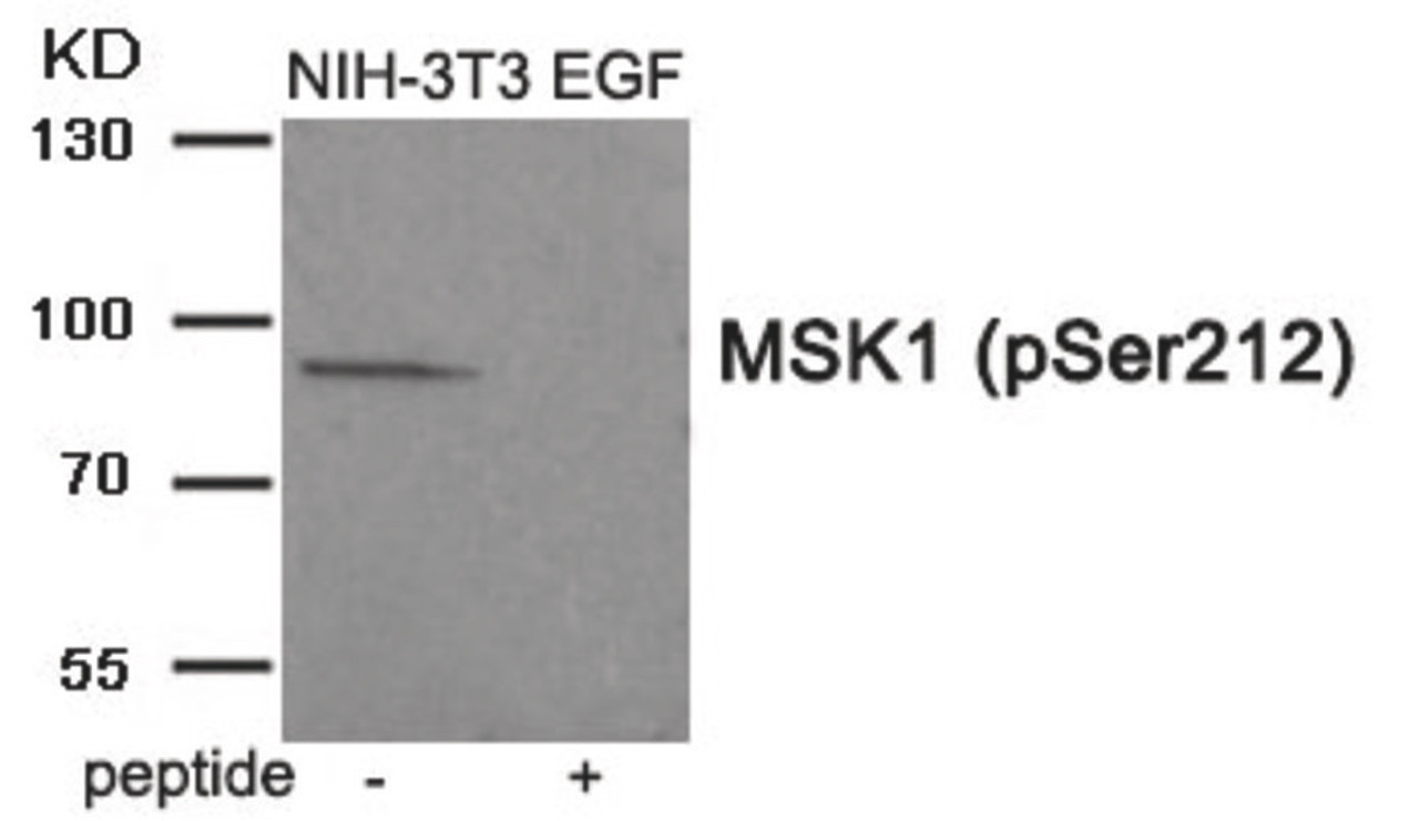 Western blot analysis of extracts from NIH-3T3 cells treated with EGF using MSK1 (Phospho-Ser212) Antibody. The lane on the right is treated with the antigen-specific peptide.