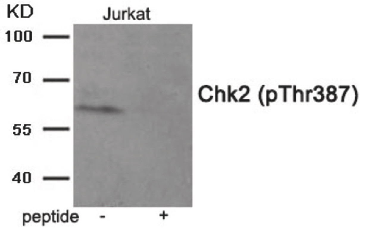 Western blot analysis of extracts from Jurkat tissue using Chk2 (Phospho-Thr387) Antibody. The lane on the right is treated with the antigen-specific peptide.
