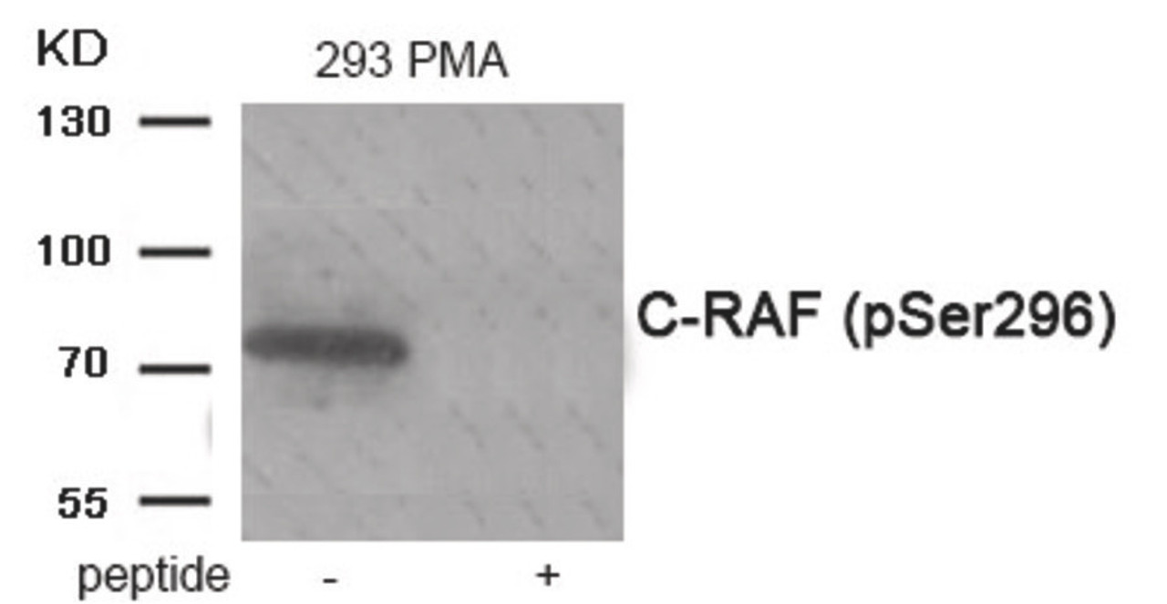 Western blot analysis of extracts from 293 cells treated with PMA using Phospho-C-RAF (Ser296) Antibody. The lane on the right is treated with the antigen-specific peptide.