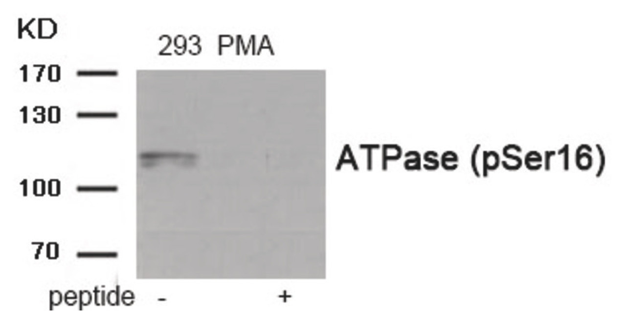 Western blot analysis of extracts from 293 cells treated with PMA using Phospho-ATPase (Ser16) Antibody. The lane on the right is treated with the antigen-specific peptide.