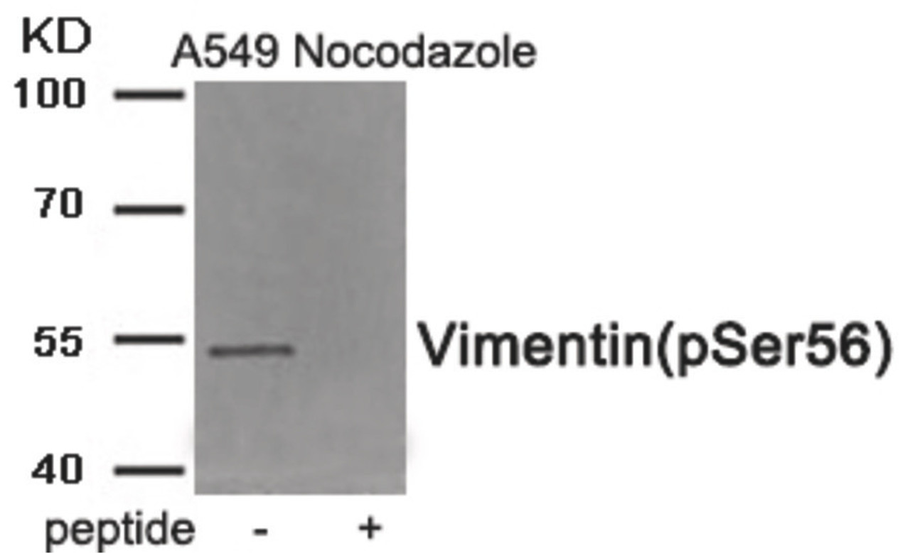 Western blot analysis of extracts from A549 cells treated with Nocodazole using Phospho-Vimentin (Ser56) Antibody. The lane on the right is treated with the antigen-specific peptide.