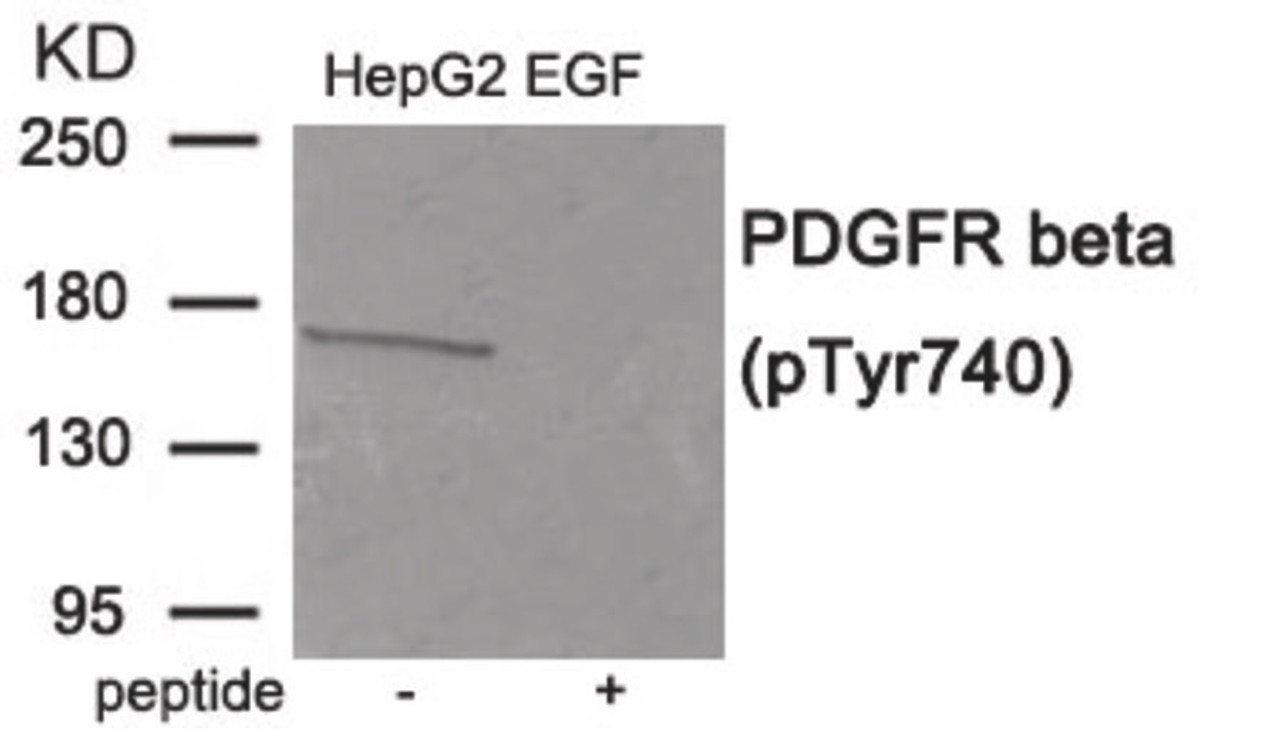 Western blot analysis of extracts from HepG2 cells treated with EGF using Phospho-PDGFR beta (Tyr740) Antibody. The lane on the right is treated with the antigen-specific peptide.
