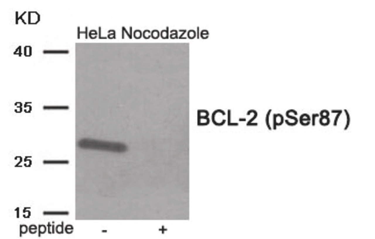 Western blot analysis of extracts from HeLa cells treated with Nocodazole using Phospho-BCL-2 (Ser87) Antibody. The lane on the right is treated with the antigen-specific peptide.