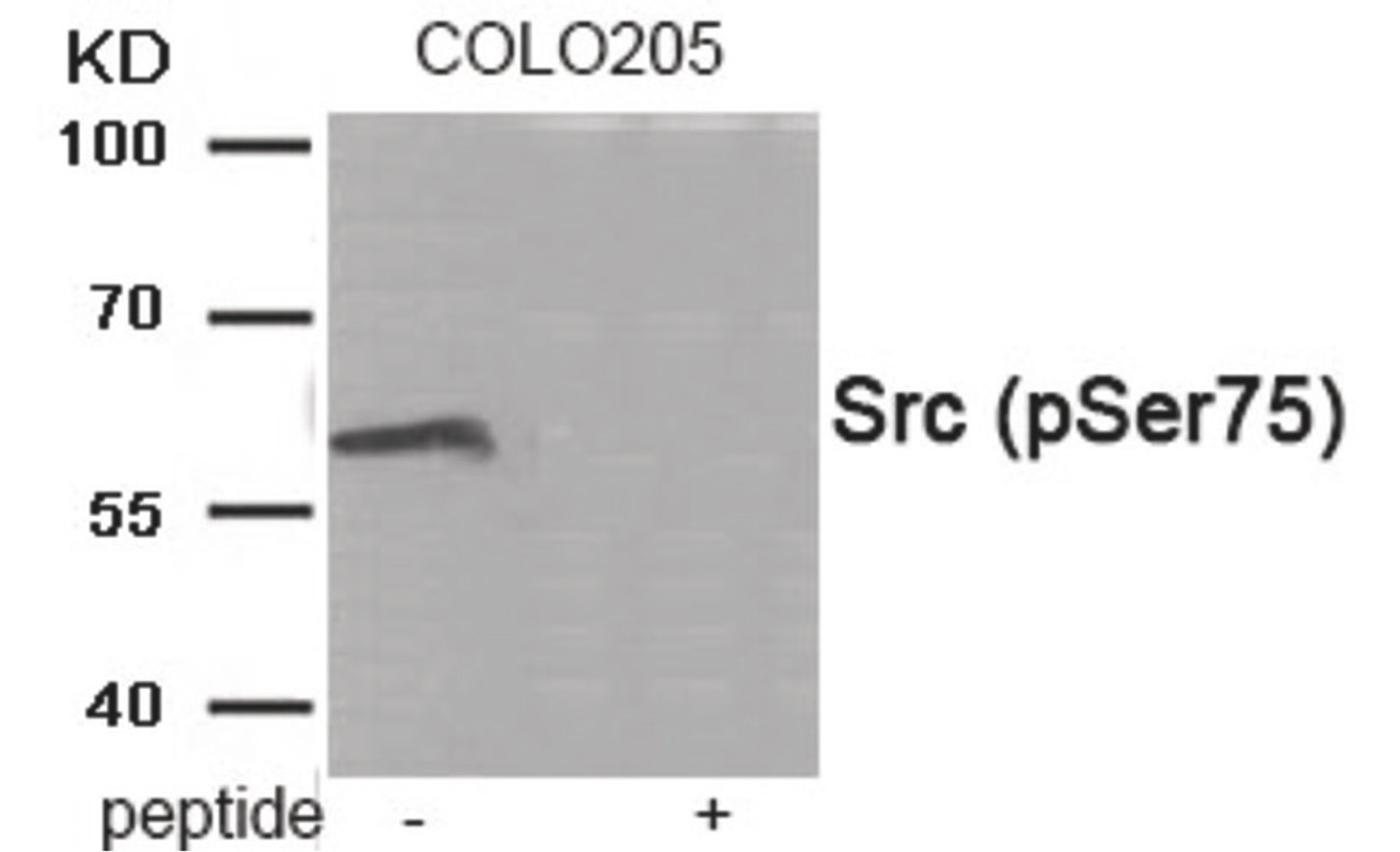 Western blot analysis of extracts from COLO205 tissue using Src (Phospho-Ser75) Antibody. The lane on the right is treated with the antigen-specific peptide.