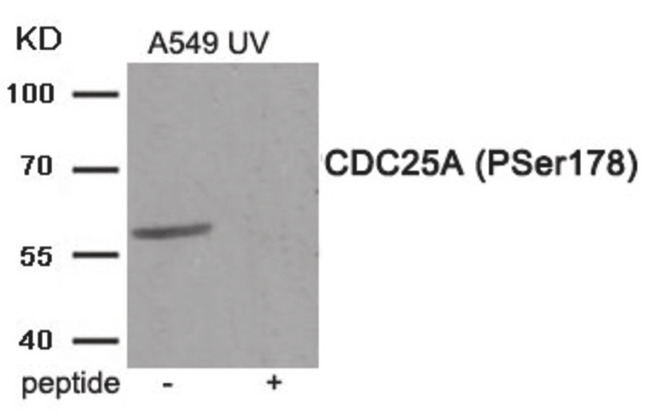Western blot analysis of extracts from A549 cells treated with UV using Phospho-CDC25A (Ser178) Antibody. The lane on the right is treated with the antigen-specific peptide.