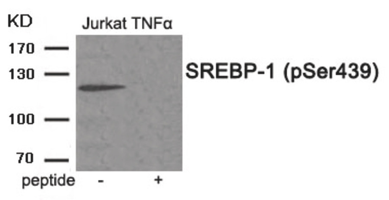 Western blot analysis of extracts from Jurkat cells treated with TNF using Phospho-SREBP-1 (Ser439) Antibody. The lane on the right is treated with the antigen-specific peptide.