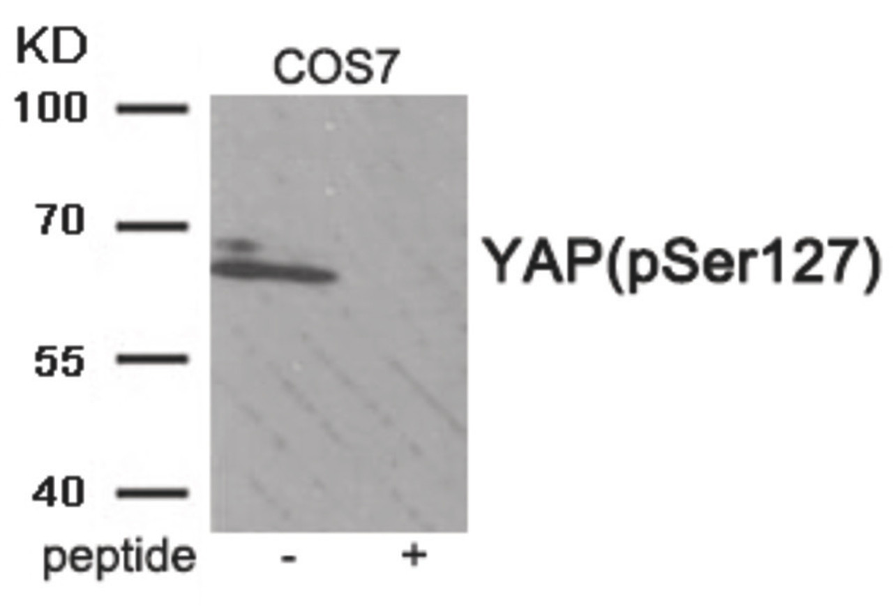 Western blot analysis of extracts from COS7 tissue using YAP (Phospho-Ser127) Antibody. The lane on the right is treated with the antigen-specific peptide.