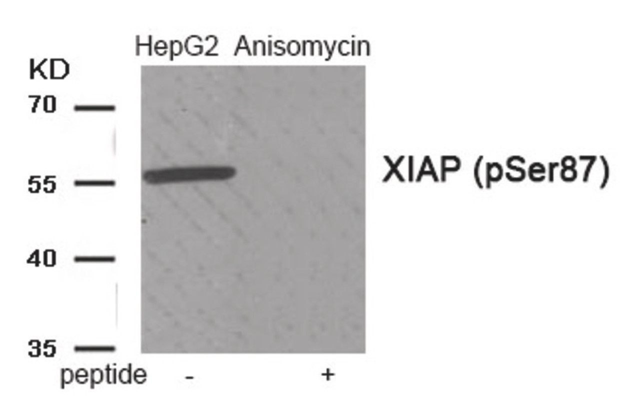 Western blot analysis of extracts from HepG2 cells treated with Anisomycin using Phospho-XIAP (Ser87) Antibody. The lane on the right is treated with the antigen-specific peptide.