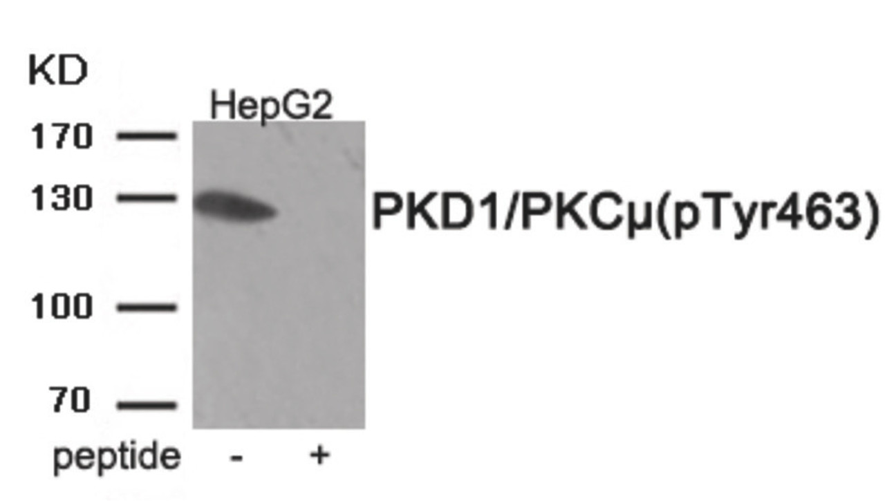 Western blot analysis of extracts from HepG2 tissue using PKD1/PKC μ (Phospho-Tyr463) Antibody. The lane on the right is treated with the antigen-specific peptide.