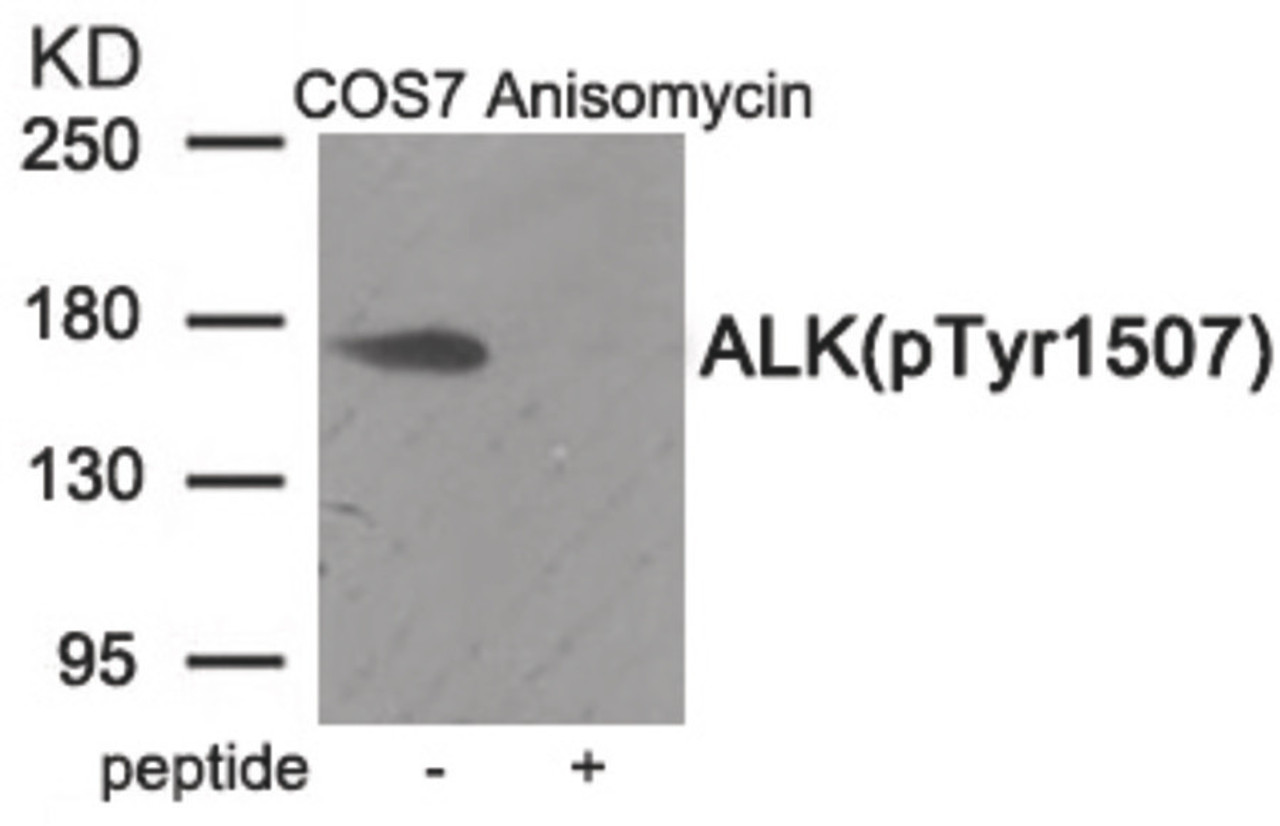 Western blot analysis of extracts from COS7 cells treated with Anisomycin using Phospho-ALK (Tyr1507) Antibody. The lane on the right is treated with the antigen-specific peptide.
