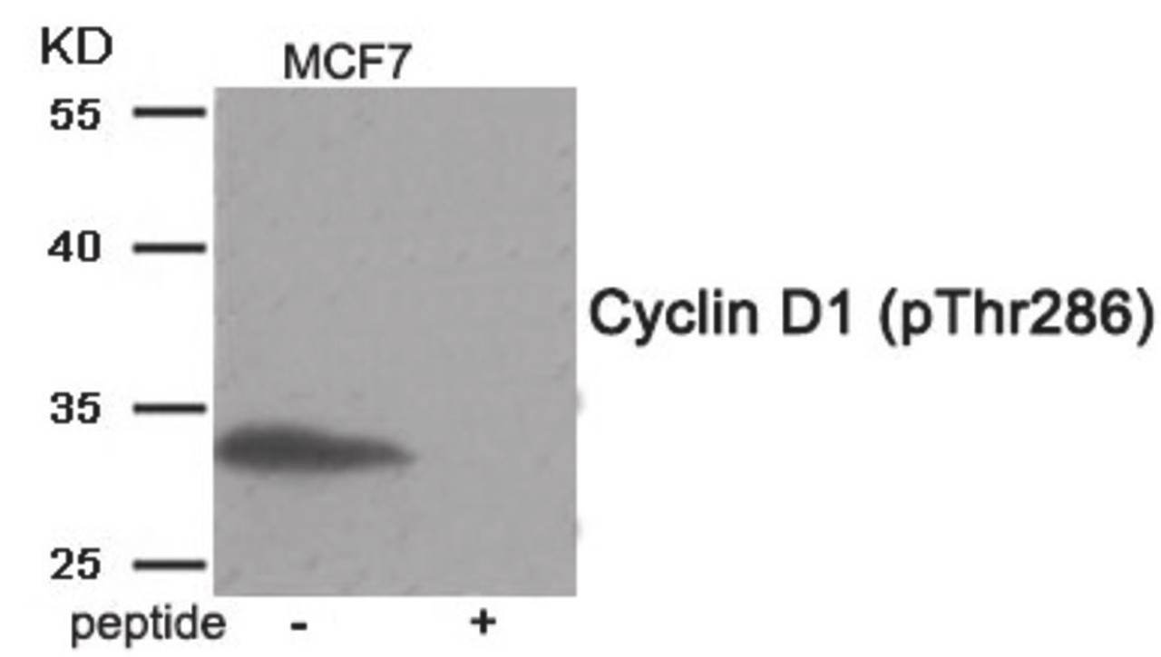 Western blot analysis of extracts from MCF7 tissue using Cyclin D1 (Phospho-Thr286) Antibody. The lane on the right is treated with the antigen-specific peptide.