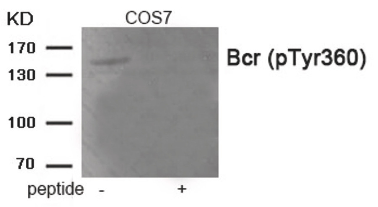 Western blot analysis of extracts from COS7 tissue using Bcr (Phospho-Tyr360) Antibody. The lane on the right is treated with the antigen-specific peptide.