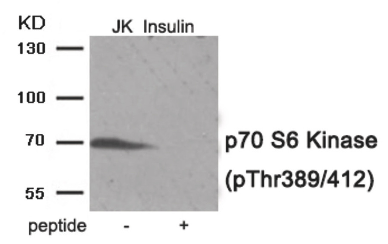 Western blot analysis of extracts from Jurkat cells treated with Insulin using Phospho-p70 S6 Kinase (Thr389/412) Antibody. The lane on the right is treated with the antigen-specific peptide.