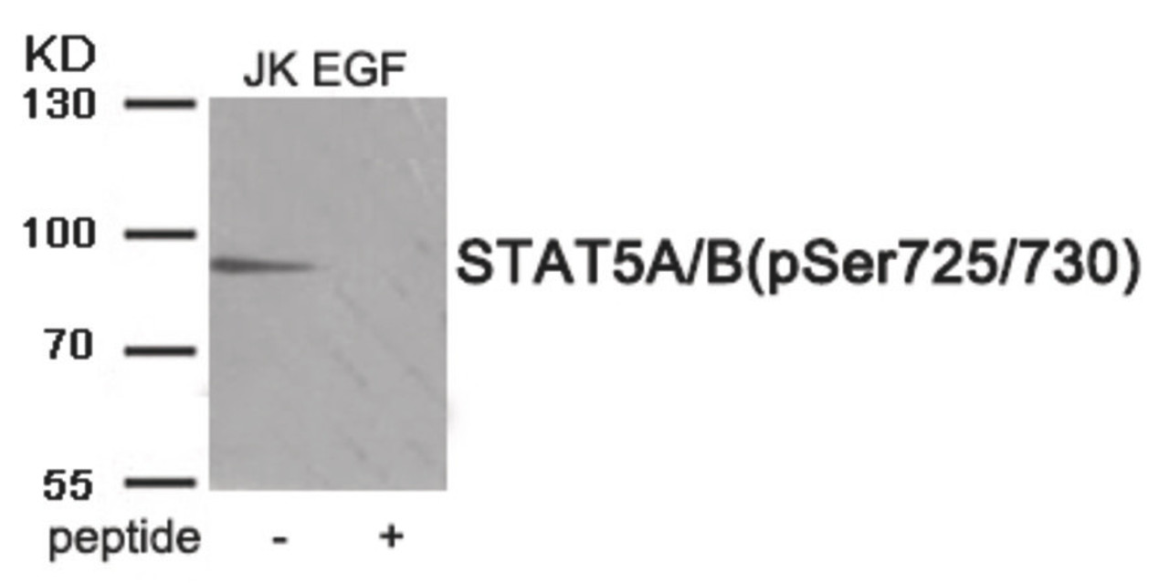 Western blot analysis of extracts from Jurkat cells treated with EGF using Phospho-STAT5A/B (Ser725/730) Antibody. The lane on the right is treated with the antigen-specific peptide.
