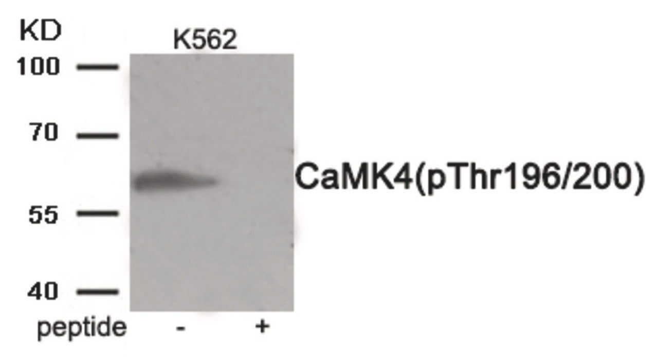 Western blot analysis of extracts from K562 cells treated with H2O2 using Phospho-CaMK4 (Thr196/200) Antibody. The lane on the right is treated with the antigen-specific peptide.