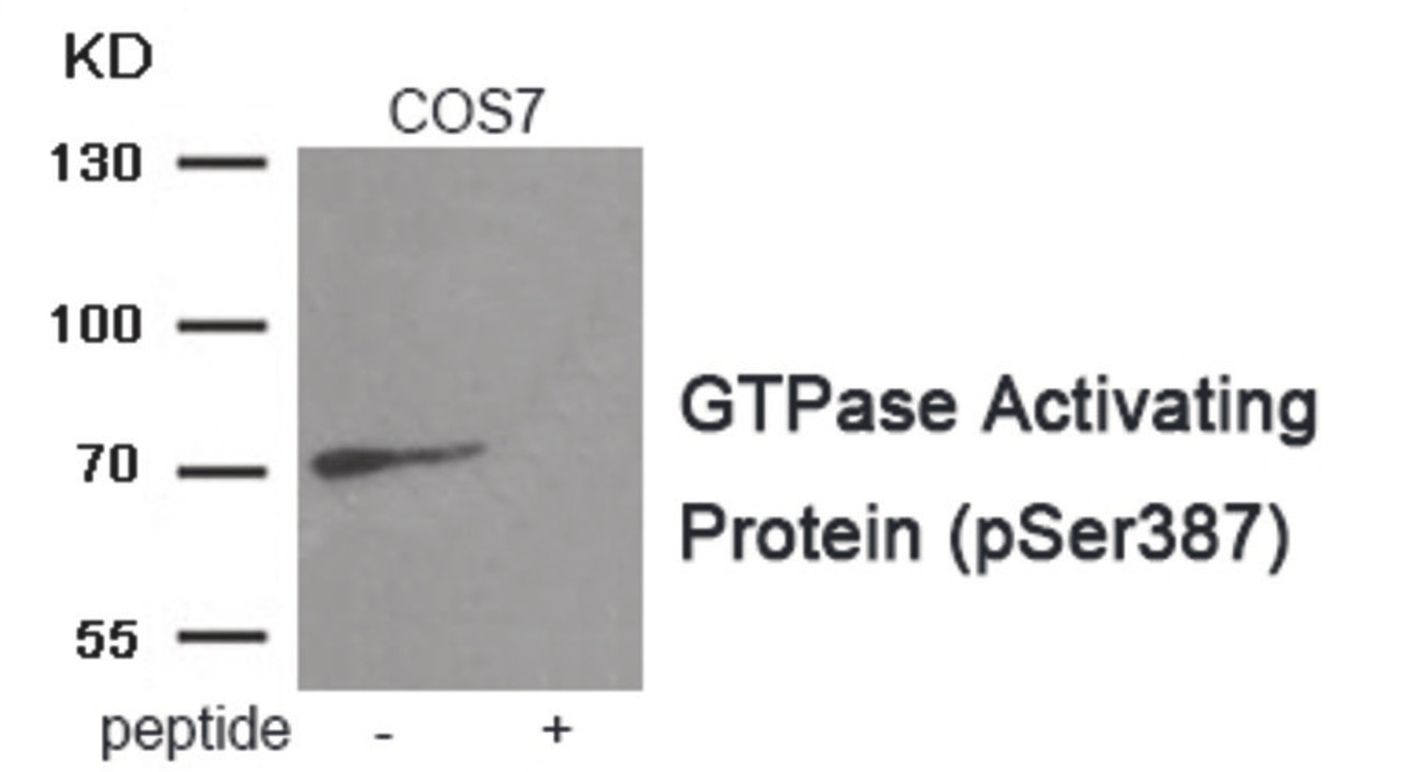 Western blot analysis of extracts from COS7 tissue using GTPase Activating Protein Antibody. The lane on the right is treated with the antigen-specific peptide.