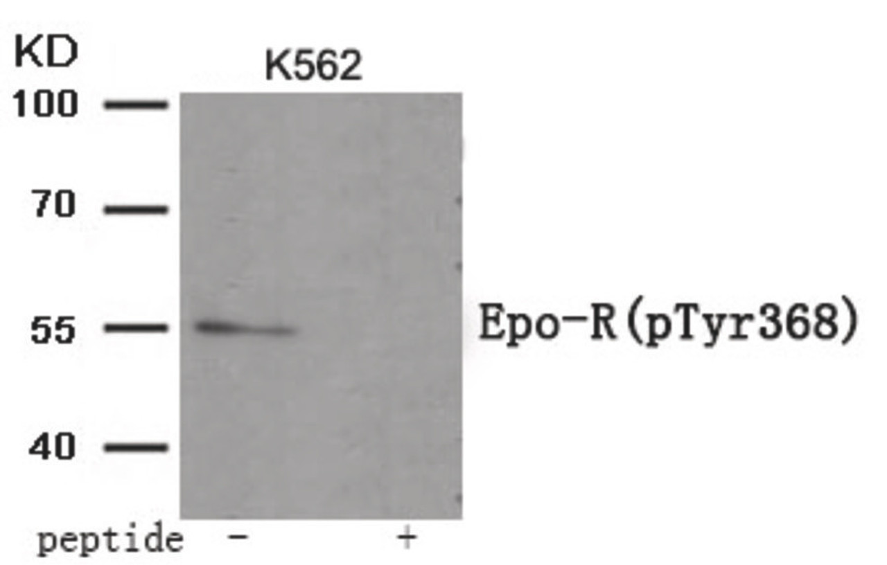 Western blot analysis of extracts from K562 tissue using Epo-R (Phospho-Tyr368) Antibody. The lane on the right is treated with the antigen-specific peptide.