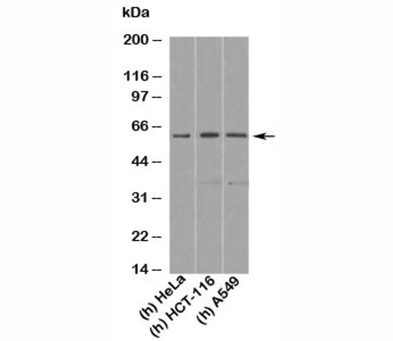 Western blot testing of human samples with KLF4 antibody at 1 ug/ml. Predicted molecular weight: 50-60 kDa + ~75 kDa