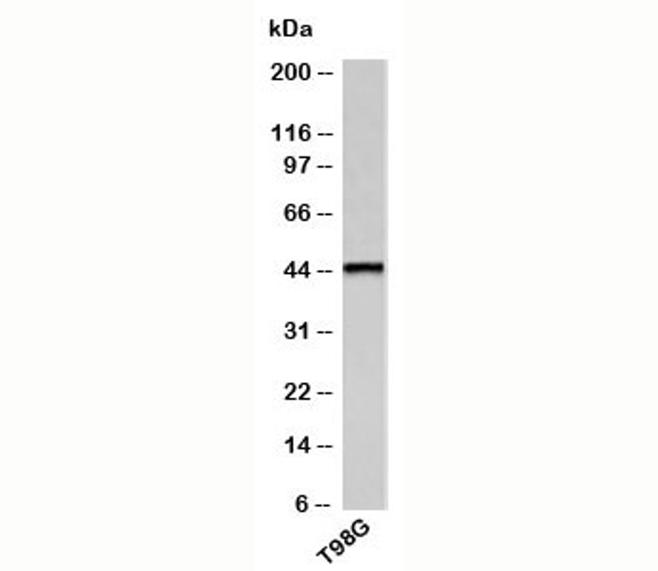 Western blot testing of human samples with TRH receptor antibody at 1ug/ml.