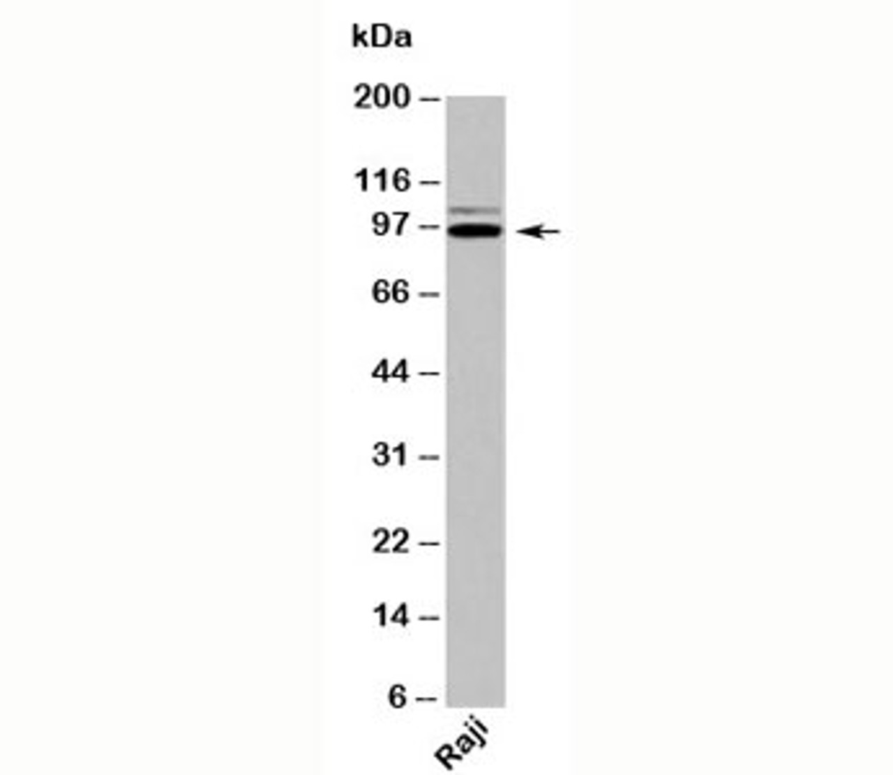 Western blot testing of human samples with TRIL antibody at 2ug/ml.