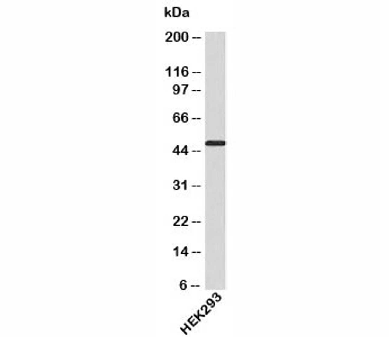 Western blot testing of human samples with ATG4B antibody at 4ug/ml.