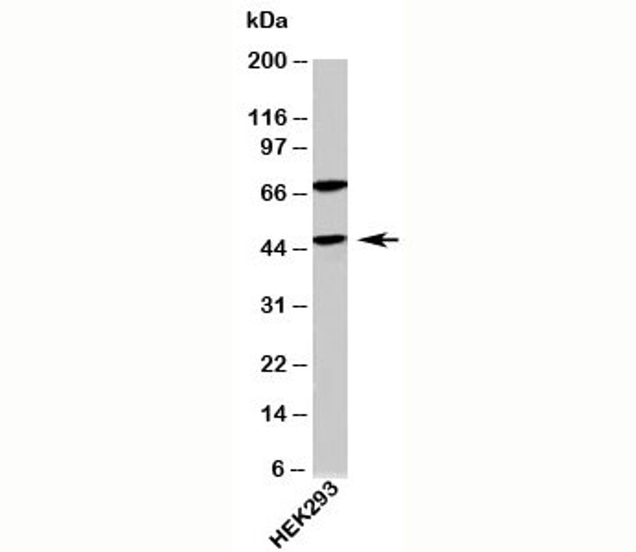 Western blot testing of human samples with ATG4B antibody at 4ug/ml.