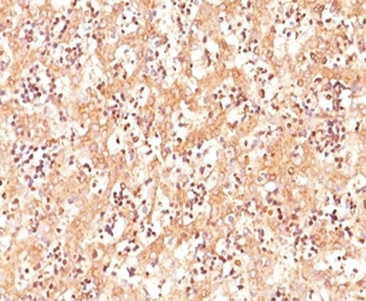 IHC testing of human fetal liver stained with AFP antibody (C3) .