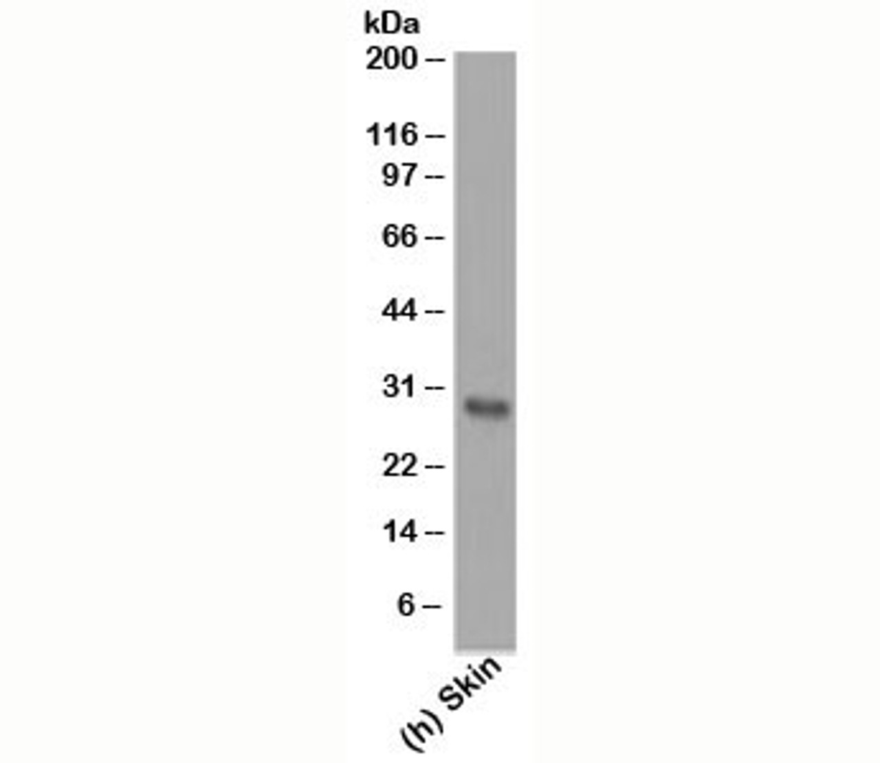 Western blot testing of human samples using Bcl-2 antibody (124) .