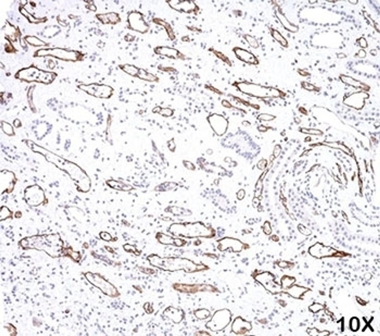 IHC testing of FFPE human kidney transplant tissue (10X) stained with C4d antibody (C4D204) .