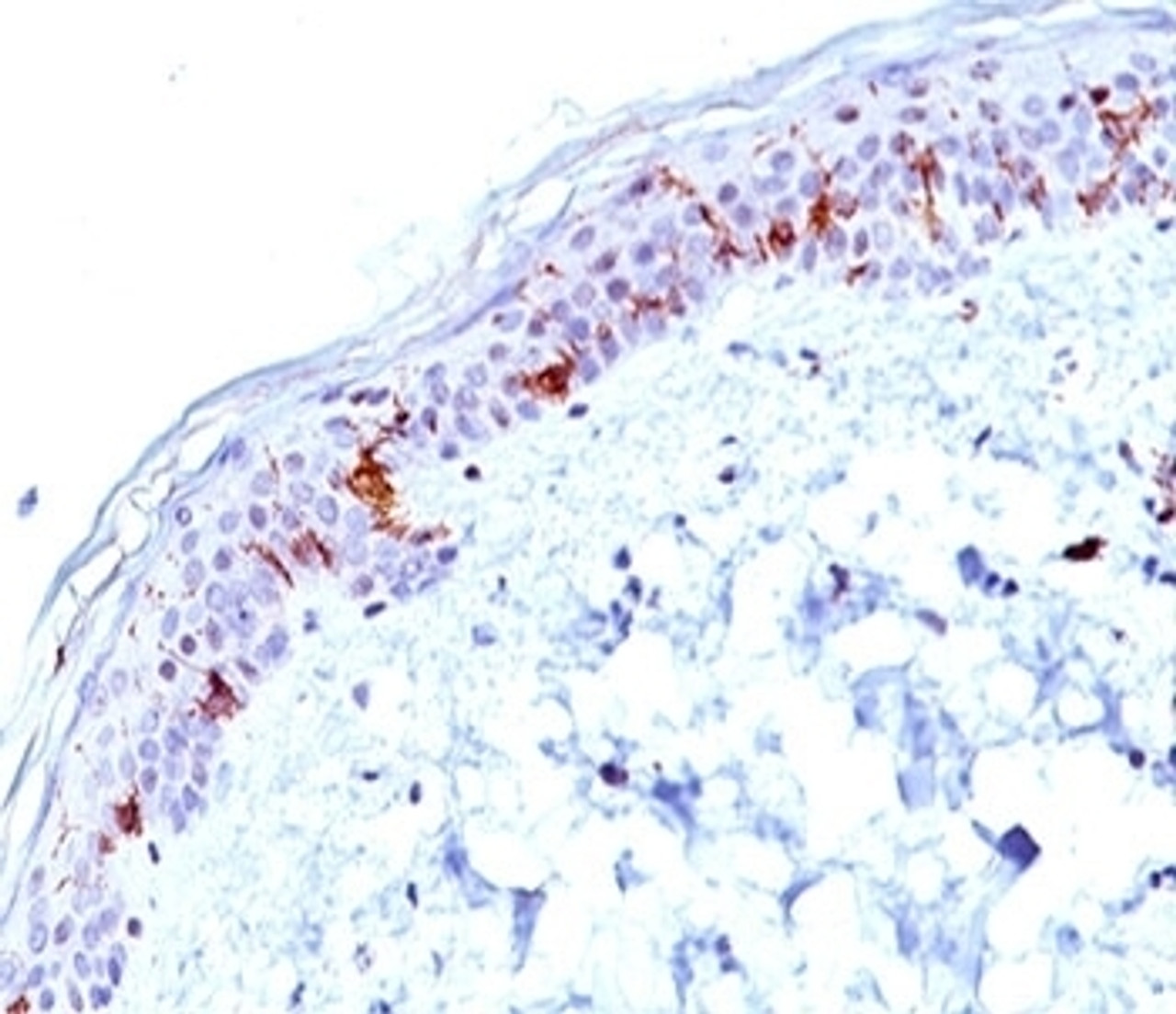 IHC testing of human skin stained with CD1a antibody (O10) .